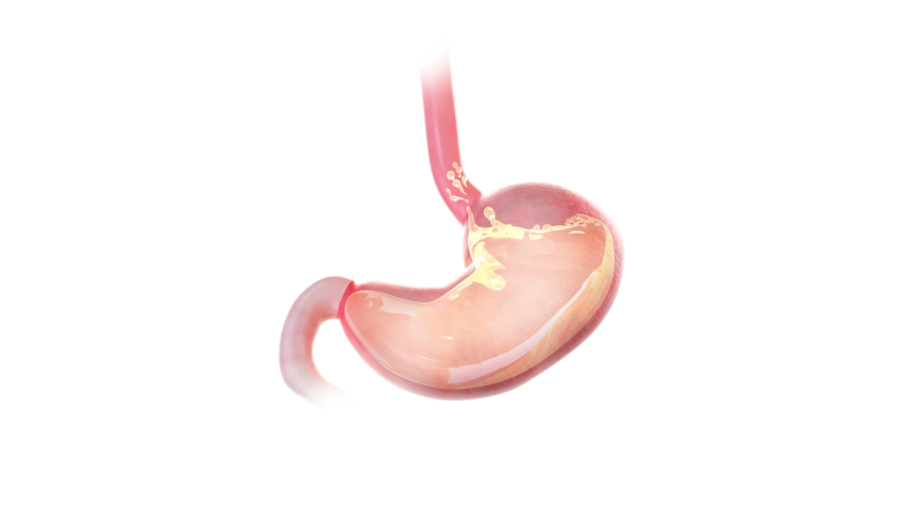 Reflujo gastroesofágico - Dr. José Carmona
