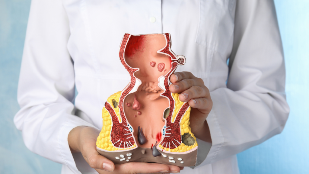 Miotomía de Heller- tratamiento acalasia - Dr. José Carmona